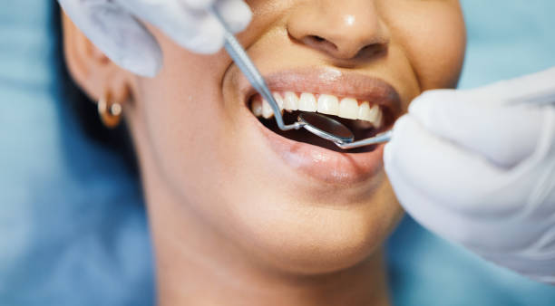 Best Chipped Tooth Repair Near Me  in West Salem, OH