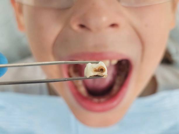 Best Emergency Pediatric Dentist  in West Salem, OH
